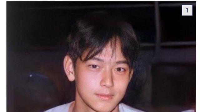 안면비대칭이 얼굴에 미치는 영향