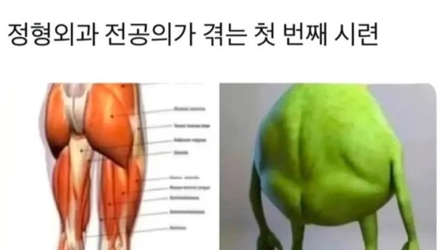 정형외과 전공의가 겪는다는 첫 번째 시련.jpg