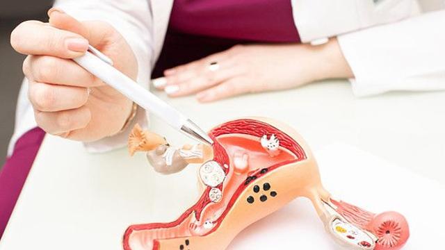 자궁경부암 수술 없이 치료한다는 비열 바이오플라즈마는?