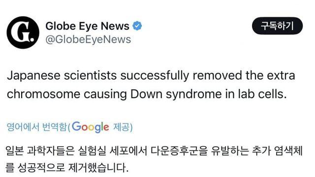 일본 다운증후군 유발 염색체 삭제 성공
