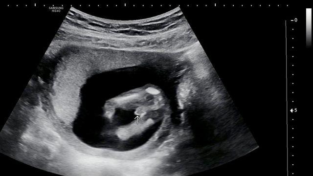 애국 후기 인증