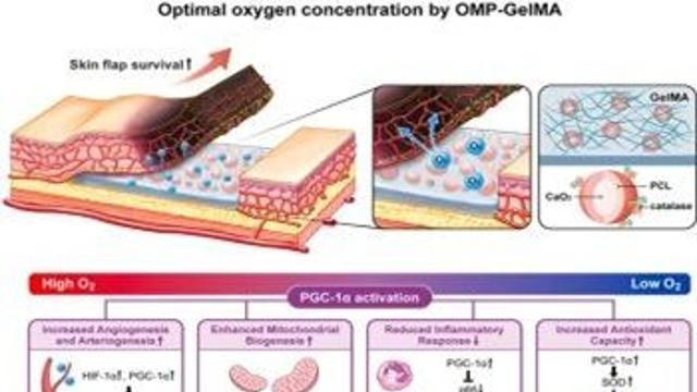 피부 괴사 막는 새 해법 제시…조직 재생 돕는 ‘산소 발생 하이드로겔’ 개발