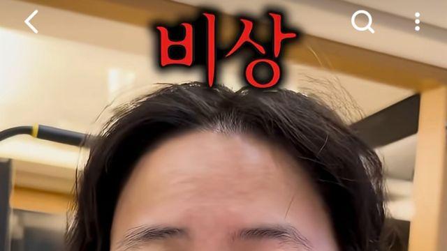 고은아, 한쪽 눈이 퉁퉁… 조카 “저희는 안 때렸어요”