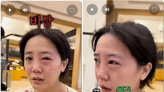 배우 고은아, 촬영 앞두고 한쪽 눈 퉁퉁…무슨 일?