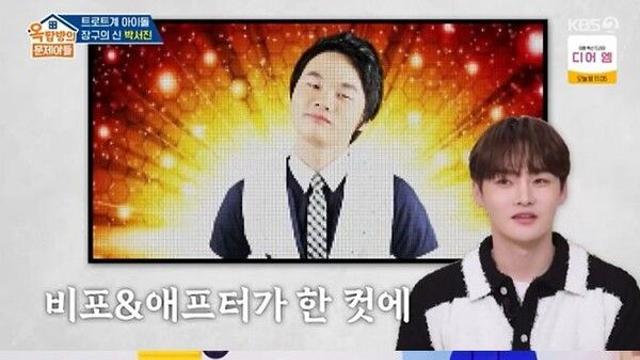 박서진, 억대 성형수술 