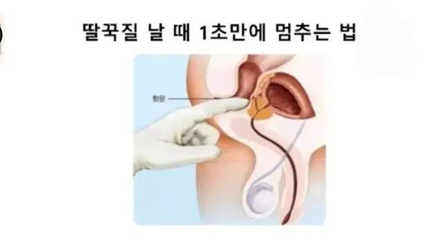 딸꾹질 날때 1초만에 멈추는법,,