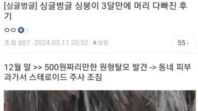 세달만에 머리카락 다 빠져버림