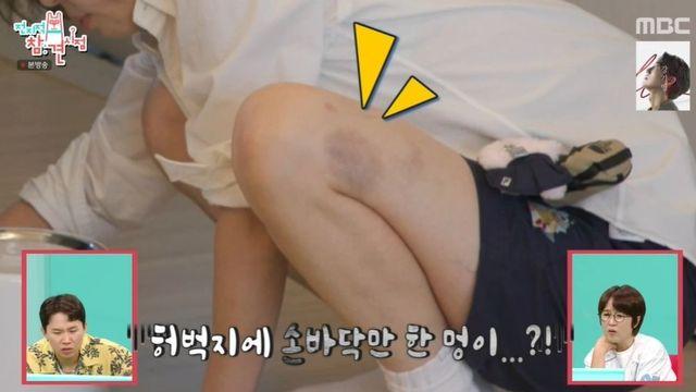 최강희, 허벅지에 멍이…”자는데 문이 덮쳐, 집 담 넘다 도둑 만난 적도” (‘전참시’) [종합]