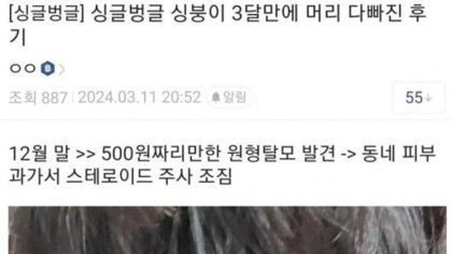 3달 만에 머리카락 다빠져버림..jpg