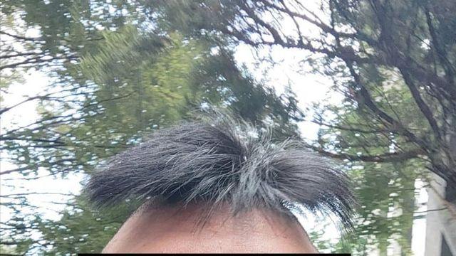 머리 개ㅅㅂ 어떡하냐