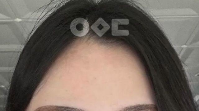 눈 성형 잘된 여성
