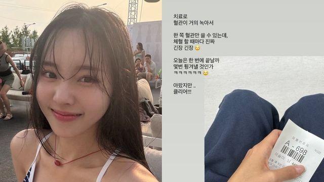 ‘박성광♥’ 이솔이 “혈관 거의 녹아”…암 투병 후 근황 고백
