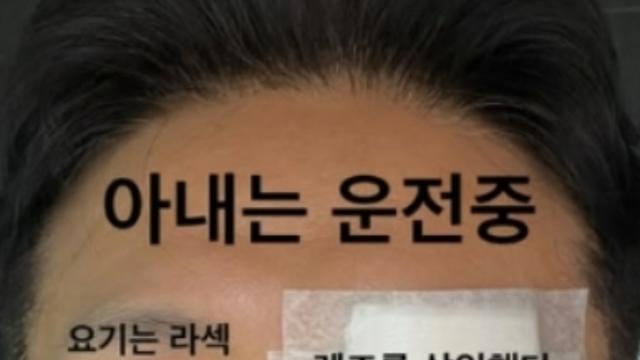 진태현, 갑상선암 수술 후 렌즈 삽입술…”♥박시은 운전 중”