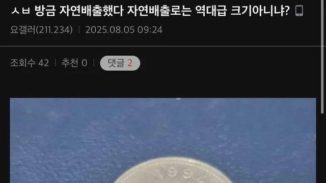 요로결석 갤러리 자연배출 크기 인증