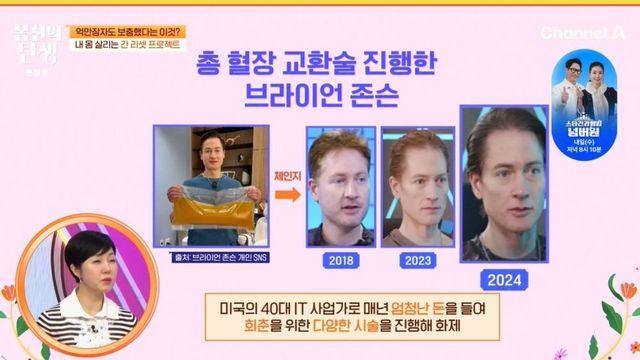 美 억만장자, 노화 막으려 연간 27억 원…”시간 거꾸로 가는 중” (‘몸신의 탄생’)
