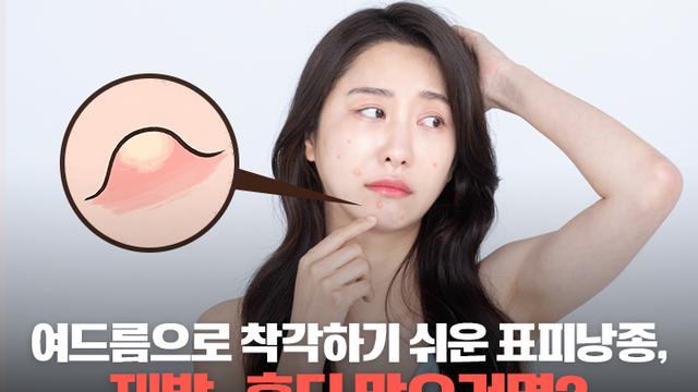 표피낭종, 여드름으로 착각 쉬운 피부 종양···재발·흉터 막으려면 정확한 진단과 치료 중요
