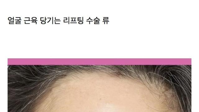 요즘 예전보다 진짜 많이하는거 체감되는 성형