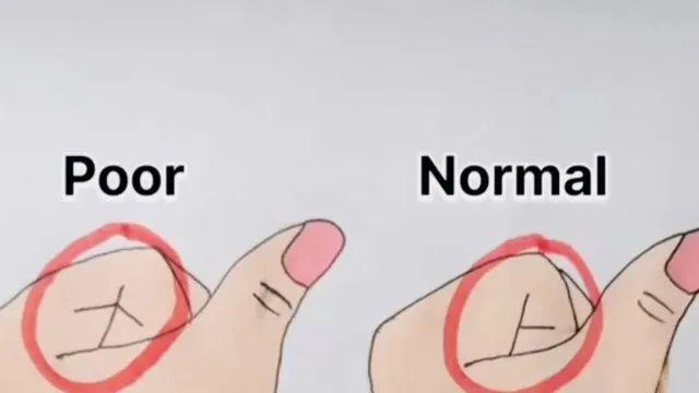 부자되는 손금?,,