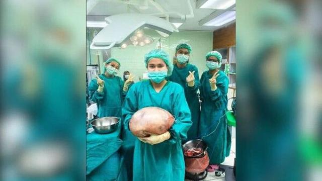 배 나온 줄 알았더니 8㎏ 종양…수년간 종양 안고 살아온 여성