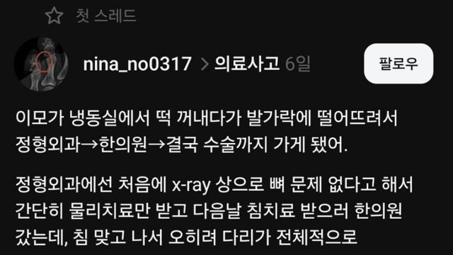 한의사-환자, 캐삭빵 논란