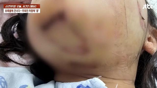 “어, 밟혔네?” 초등생 들이받은 80대 무면허 운전자