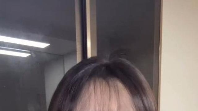 허안나 코 재수술, 구축 피해 호소 “코가 점점 들려”