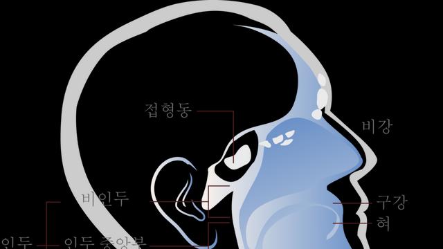 두경부암 치료제 시스플라틴 효과가 떨어지는 이유