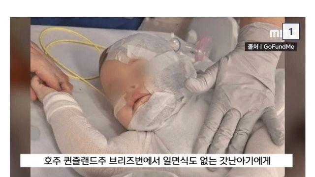 1년전 호주에서 아기한테 커피 퍼붓고 도주한 사건 근황 