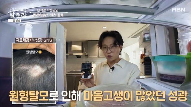박성광 “원형탈모로 고생 많이 했다…’이것’으로 치유” 비법 공개 (알토란)
