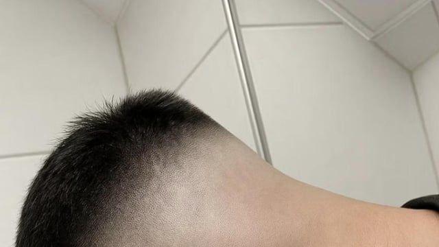 이거 엄지에 털난 사진이지?
