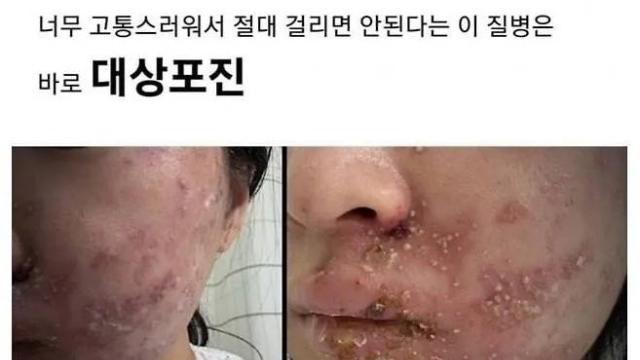 너무 아파서 걸리면 안된다는 병