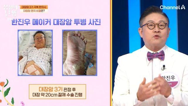 대장암 3기였던 한의사…”죽다 살아나, 대장암 걸릴 행동 했다” (‘몸신의 탄생’)