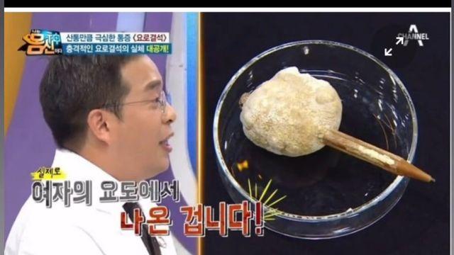 요로결석에 걸린이유