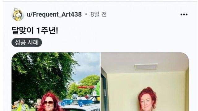 요즘 미국에서 정복되고 있다는 질병