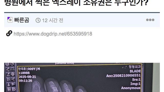 엑스레이 사진 폰으로 촬영하다 도둑으로 몰린 사람