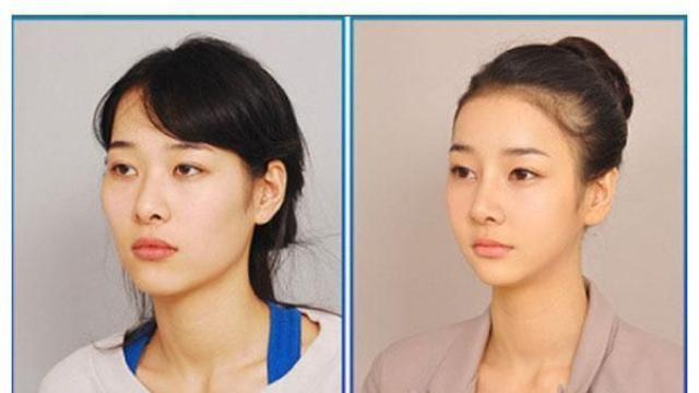양웹에서 논란되는 한국 성형짤