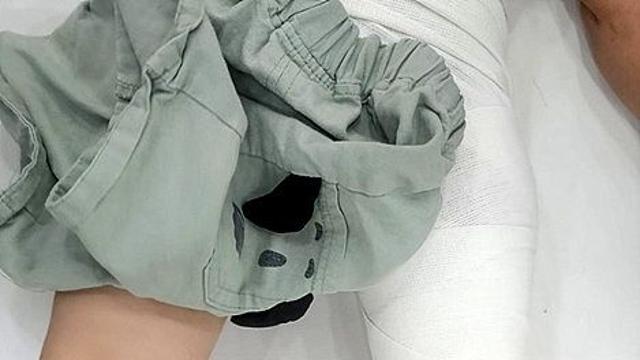 장애 핑계 뒤 잠적? 놀이공원서 3세 아동 폭행 입길