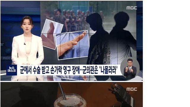 군에서 받은 손가락 수술