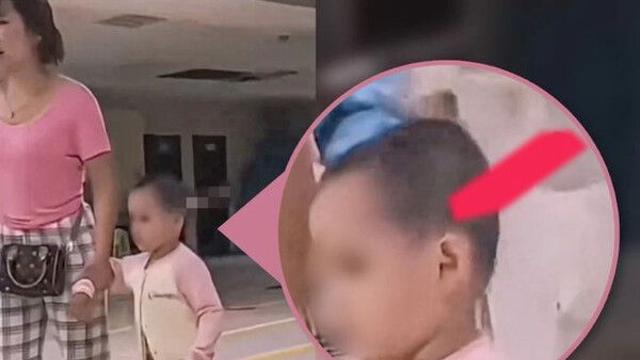 딸 머리에 흉기 꽂힌 채 걷는 모녀 '태연'…中 충격 영상