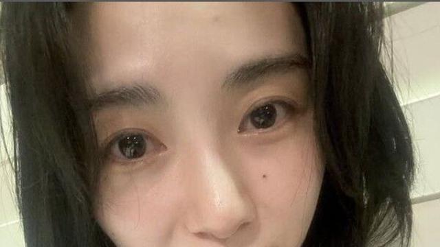 AOA 출신 권민아, 피부과 상담실장 그만뒀다