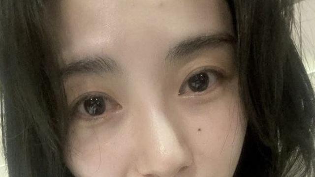 ‘AOA 출신’ 권민아, 피부과 상담실장직 내려놓고 근황 공개
