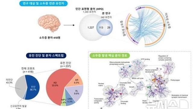 머리작은 '소두증' 원인 밝혀냈다…'이 유전자' 결실 때문
