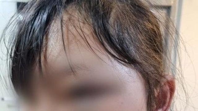 여성 이주노동자 얼굴 발로 걷어찬 40대 징역 1년 '실형'