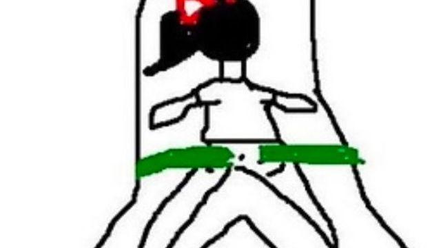 치질 수술의 비밀