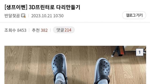 3D 프린터로 자기 다리 만든 디시인