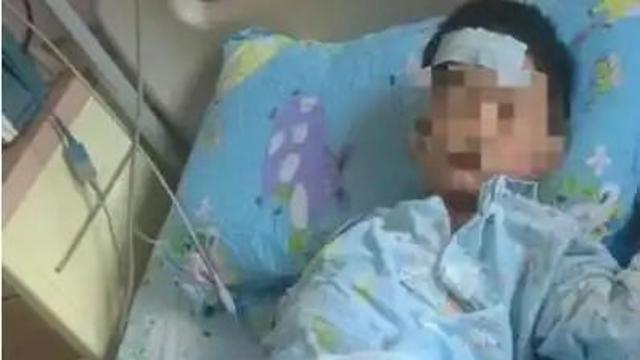 죽은 물고기 밟았다가… 中 6세 아이, 다리 절단 위기