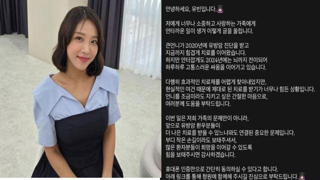 원더걸스 유빈 