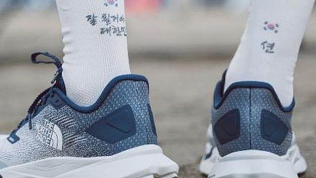 틈만 나면 나가서 뛰었던 션, 결국 '발 상태' 진짜 심각해졌다