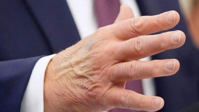 thumbimg