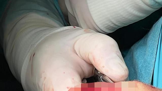 '밥 먹는 사람 열람 금지!' 쿨루세브스키, '피 철철' 무릎 수술 사진 공개→팬 충격과 공포 